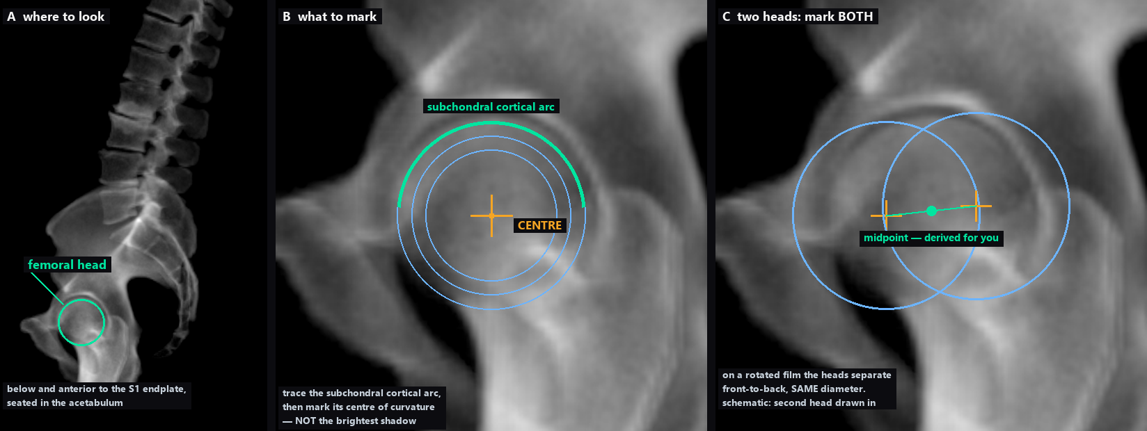 Three panels: where the femoral head is on a lateral film, the
                    concentric-circle construction on its centre, and the two-head case.